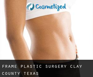 Frame plastic surgery (Clay County, Texas)
