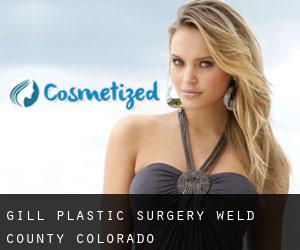 Gill plastic surgery (Weld County, Colorado)