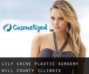 Lily Cache plastic surgery (Will County, Illinois)