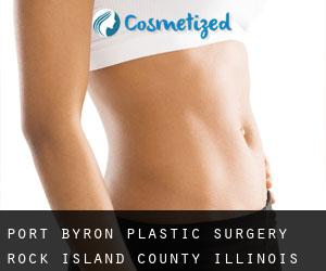 Port Byron plastic surgery (Rock Island County, Illinois)