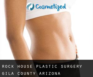 Rock House plastic surgery (Gila County, Arizona)